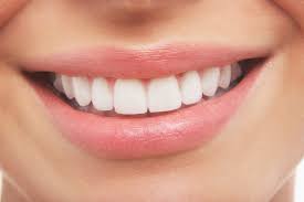 Snowhite Teeth Whitening - bielenie zubov – mienky – ako použiť – feeedback