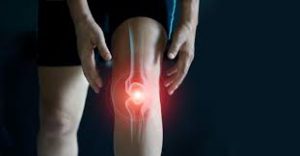 Motion Energy - na bolesti kĺbov – cena – recenzie – výsledo
