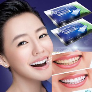 Dental Whitestrips - ako použiť - ako to funguje - Advanced Teeth Whitening Strips