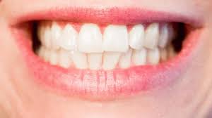 Dental Whitestrips - bielenie zubov - účinky - feeedback - mienky